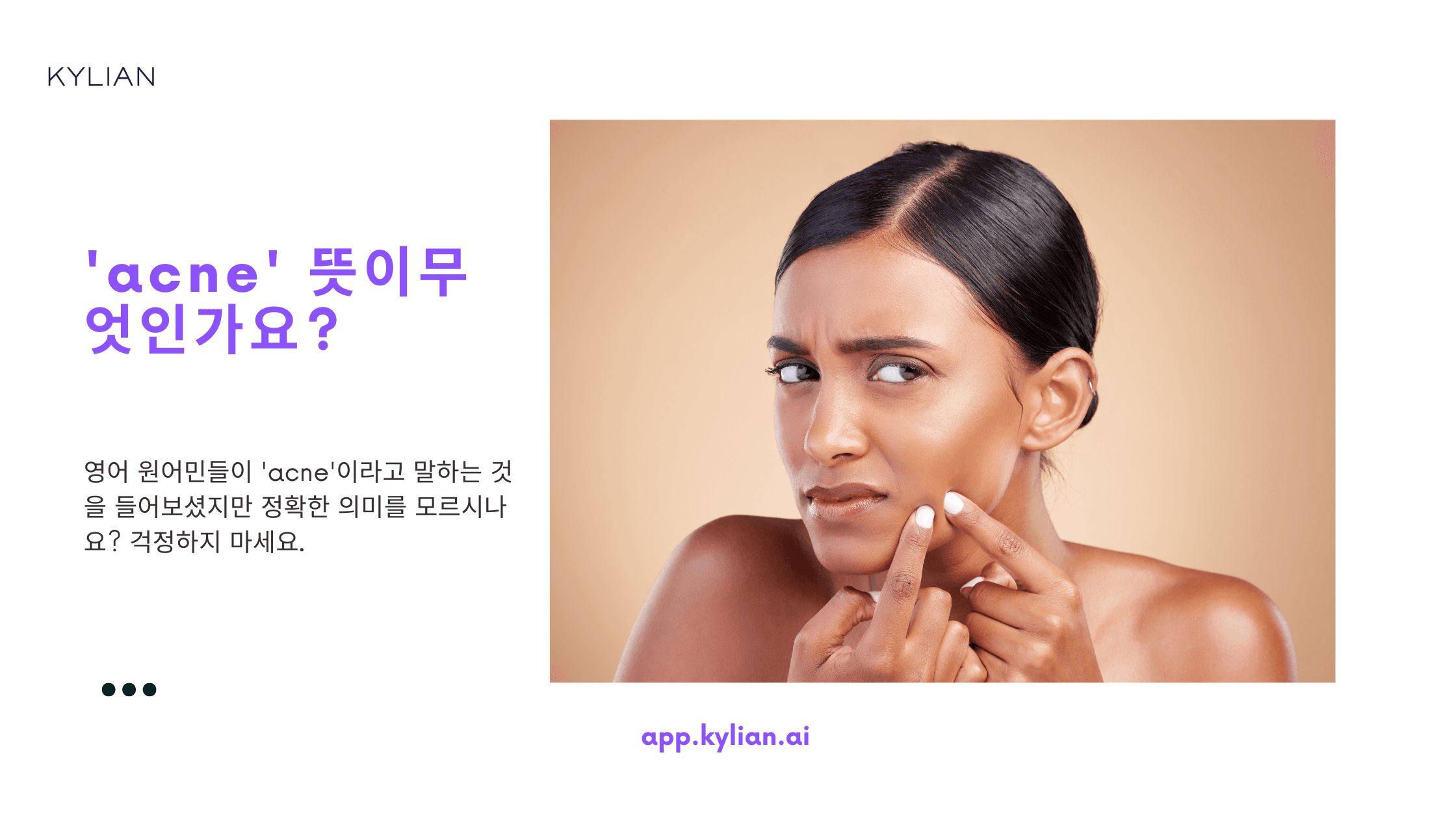 얼굴에 여드름 났을 때, ‘여드름’ 영어로 표현하기